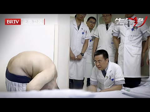 世界罕见折叠人，身体弯曲180度艰难生活，28年后敲断骨头重新开启直立人生【生命缘之生命的礼物第3季】