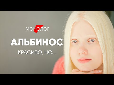 Рядом со мной загадывают желания: #монолог альбиноса