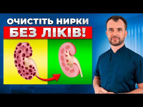 Камені в нирках розчиняться назавжди! Простий та ефективний спосіб