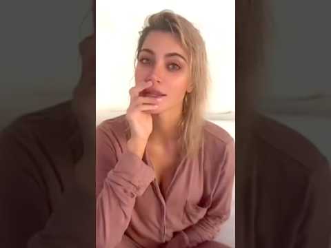 Did Kim Kardashian have a Hair Transplant?