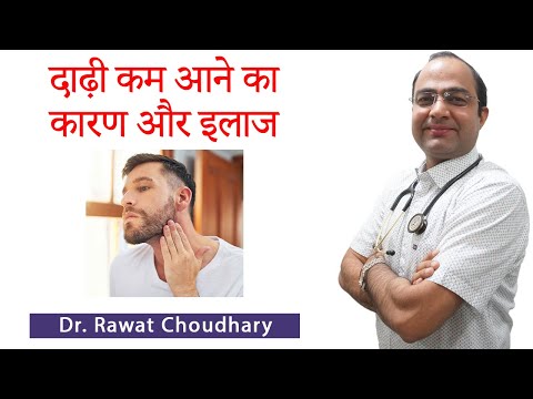 How to grow beard | दाढ़ी कम आने के कारण और इलाज | Best Homeopathic Treatment for Beard Growth