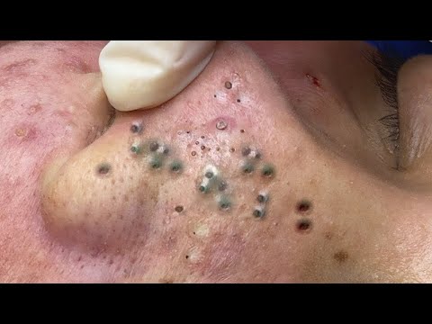 𝑺𝒐𝒐𝒕𝒉𝒊𝒏𝒈 𝑭𝒂𝒄𝒊𝒂𝒍 𝑻𝒓𝒆𝒂𝒕𝒎𝒆𝒏𝒕 𝒇𝒐𝒓 𝑺𝒕𝒓𝒆𝒔𝒔 𝑹𝒆𝒍𝒊𝒆𝒇 | 𝑫𝒆𝒆𝒑 𝑪𝒍𝒆𝒂𝒏𝒊𝒏𝒈 & 𝑪𝒂𝒍𝒎𝒊𝒏𝒈 𝑴𝒂𝒔𝒔𝒂𝒈𝒆 𝒂𝒕 𝑳𝒖𝒙𝒖𝒓𝒚 𝑺𝒑𝒂 #48807