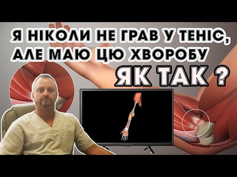 Я ніколи не грав у теніс, але маю цю хворобу. Як так? Латеральний епіконділіт (лікоть тенісиста)
