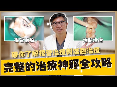 【蛀牙#9】根管治療一定得抽神經嗎？活髓治療其實也是根管治療的一種！｜治療神經全攻略帶你完整了解根管治療【醫師說重點】｜【祐民牙醫－隱適美旗艦店】鑽石級楊大為醫師 #根管治療 #抽神經 #活髓治療