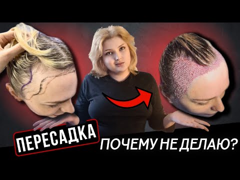 Андрогенная алопеция у женщин | Почему я НЕ делаю пересадку волос?