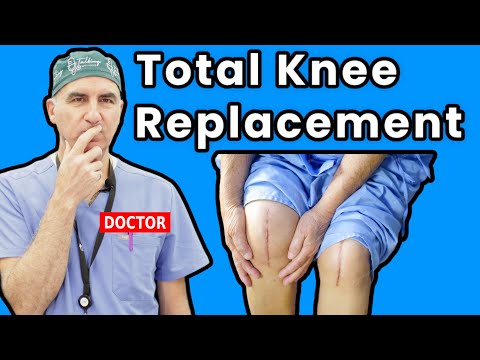 Life at Home After Total Knee Replacement: Essential Recovery Guide