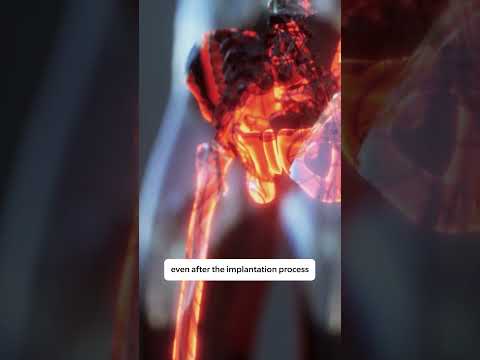 How the Black Dragons turned the Cursed Founding Mutation into a Weapon #warhammer40k