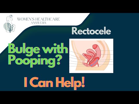 How to Fix Rectocele Without Surgery