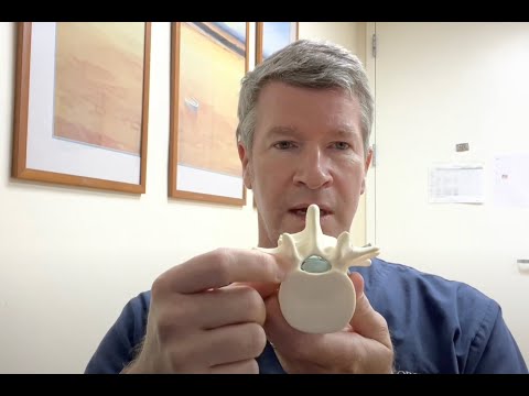 LSS: What are the available treatments for spinal stenosis in 2023? Open surgery VS MIS for pain.