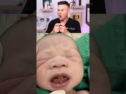 This Baby Was Born With TEETH! 😮🦷