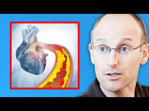Cardiologist Explains Why LDL Cholesterol Is a POOR PREDICTOR of Clogged Arteries | Dr. Bret Scher