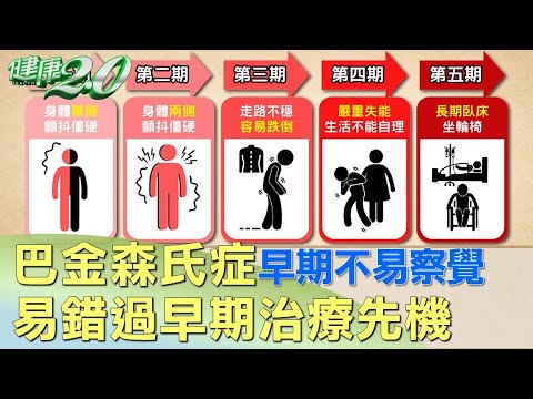 巴金森氏症早期不易察覺 易錯過早期治療先機 健康2.0 @tvbshealth20
