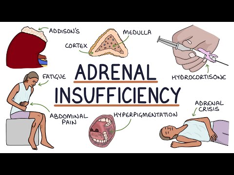 Understanding Adrenal Insufficiency