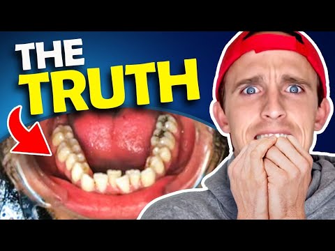 Bad experience with Smile Direct Club...WATCH BEFORE YOU BUY! Orthodontist REACTS