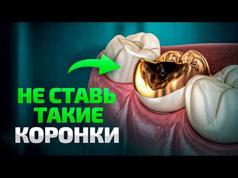 Какие КОРОНКИ выбрать в 2025 году? Подробный гайд от главного ортопеда