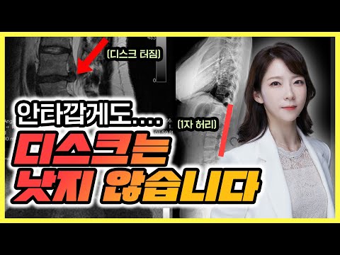 허리디스크 정말 완치 가능?  병원 가지 않으려면 꼭 시청 필수 !