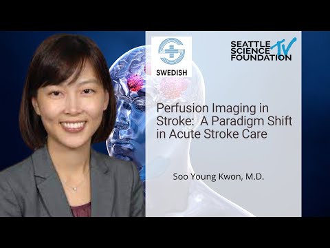 Perfusion Imaging in Stroke:  A Paradigm Shift in Acute Stroke Care – Soo Young Kwon, M.D.