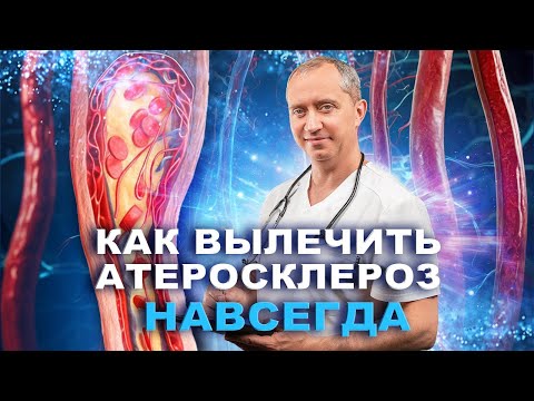 Как вылечить атеросклероз?
