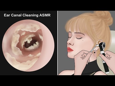 Detailed Ear Canal Cleaning process with ultra-realistic sounds  | oddly satisfying ASMR animation
