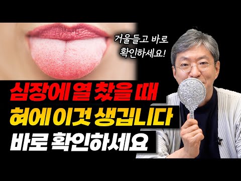 심장에 열이 차고 기능이 저하되면 혀에 이것 나타납니다. [혀로 보는 심장(심열) 건강 상태]