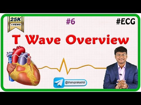 6. T Wave Overview - ECG assessment and ECG interpretation made easy