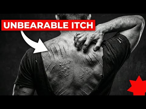 Why This “Gentle” British Powder Made U-Boat Crews Claw Their Own Skin Off in Minutes