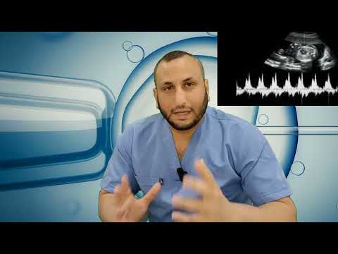 متى يظهر نبض الجنين في الحمل؟ / دكتور محمد خليل