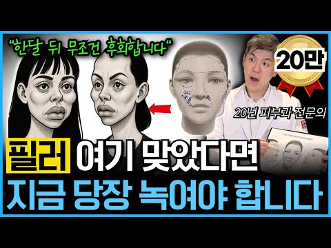 “이 3곳은 절대 맞지마세요” 필러 진짜 맞으면 안되는 부위, 부작용과 추천 부위를 20년차 피부과 전문의가 알려드립니다