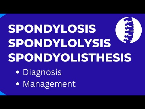 Spondylosis Spondylolysis Spondyolisthesis Difference Diagnosis & Management
