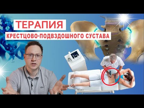 Терапия крестцово-подвздошного сустава (КПС)