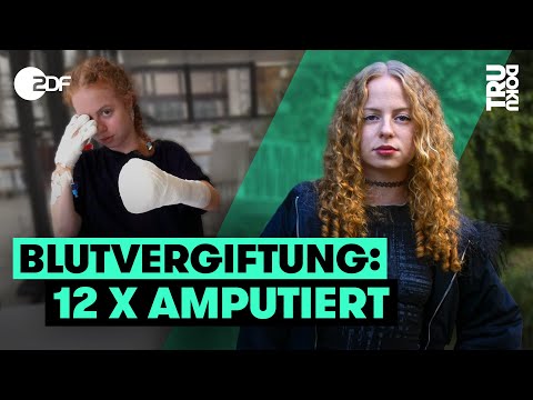 So lebt Justina ohne Finger und Unterschenkel | TRU DOKU