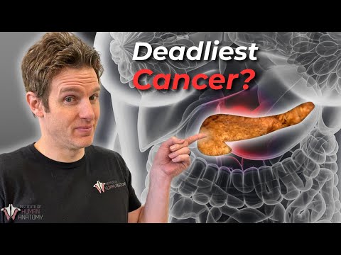 Why Pancreatic Cancer is So Deadly