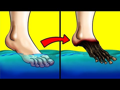 You Wouldn't Survive Dipping Your Toe In This Lake