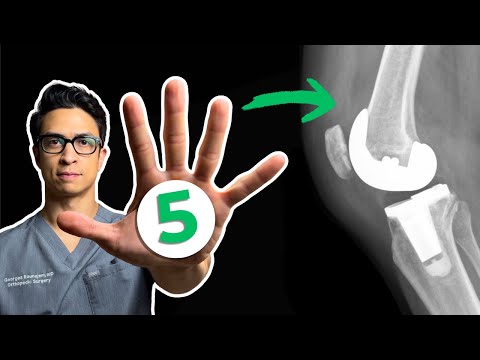 Doctor’s Top 5 Knee Replacement Exercises (First 2 Weeks)