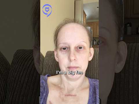 I Will Never Be The Same After My Stage 4 Cancer Diagnosis