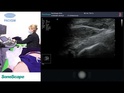 Мастер-класс на аппарате S40Exp. Лектор: Салтыкова В.Г.