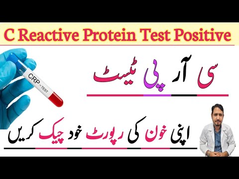 C Reactive Protein Blood Test Urdu Hindi | CRP Blood Test | CRP Test Normal Levels | Irfan Azeem |