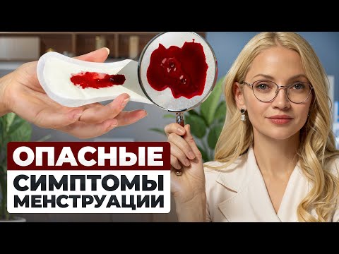 Сгустки при месячных — норма или болезнь?