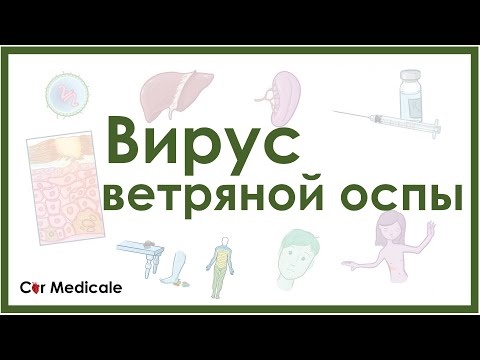 Вирус ветряной оспы (ветрянка и опоясывающий лишай) - клиника, диагностика, лечение