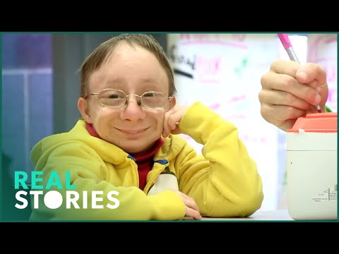 The Boy Who'll Never Grow Up (Extraordinary Person Documentary) | Real Stories