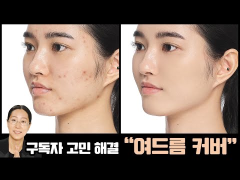 [ENG] 구독자 고민 해결! 여드름 자국, 진한 잡티 쉽고 완벽하게 커버하기! How to: Cover Acne & Blemishes