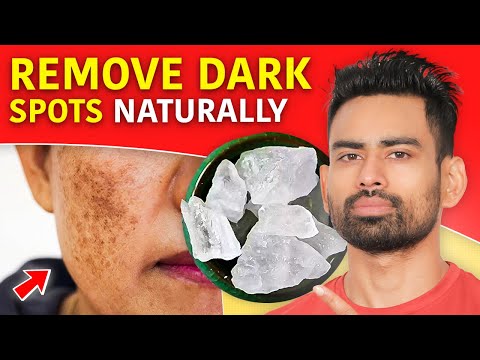 How to Remove Dark Spots and Get Clear Skin? (Pigmentation, Dark Underarms, Acne scars & more)