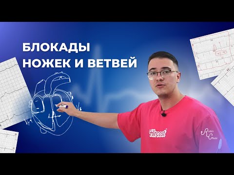 Блокады ножек и ветвей