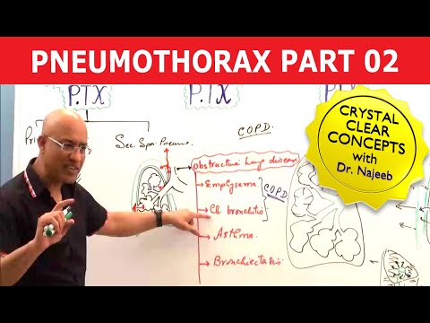 Pneumothorax | Basic Pathology | Part 2🩺