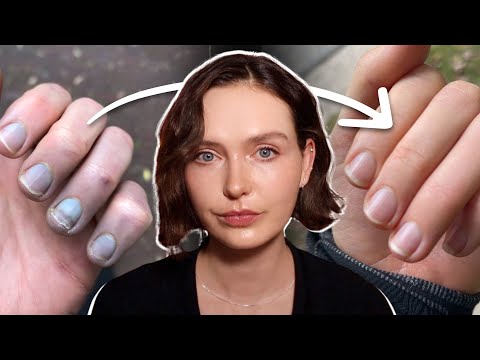 From inflamed to calm — this Elimination Diet changed my life.