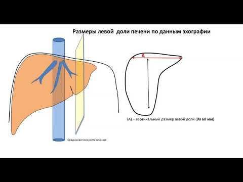 Лекция: Размеры печени (с демонстрацией на пациенте)