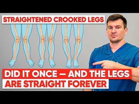 BOW LEGS STRAIGHTEN FOREVER WITHOUT SURGERY. Do it once and they will be perfectly straight