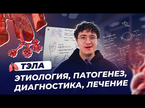 ТЭЛА  Этиология, патогенез, диагностика, лечение