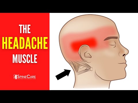 The Headache Muscle (How to Release It for INSTANT RELIEF)