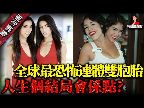 全球最恐怖連體雙胞胎Top 10！共享同一個身體嘅姊妹，如果愛上唔同男人會點？【阿姐講奇聞】未解之謎｜歷史｜神秘學